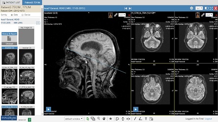 pacs, pacs software, tele radiology, tele radiology pacs, tele radiology software, teleradiology, teleradiology pacs, teleradiology software, radiology pacs, radiology pacs software, hospital pacs, hospital pacs software, radiology pacs india