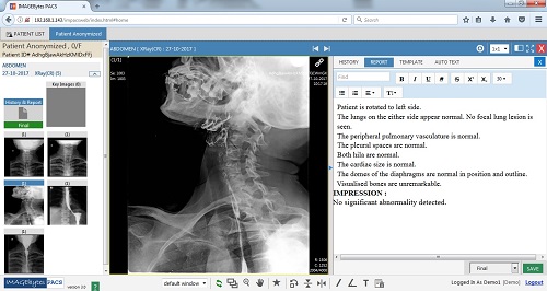 pacs, pacs software, tele radiology, tele radiology pacs, tele radiology software, teleradiology, teleradiology pacs, teleradiology software, radiology pacs, radiology pacs software, hospital pacs, hospital pacs software, radiology pacs india